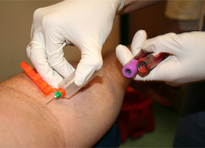 the-critical-role-of-phlebotomy-technicians